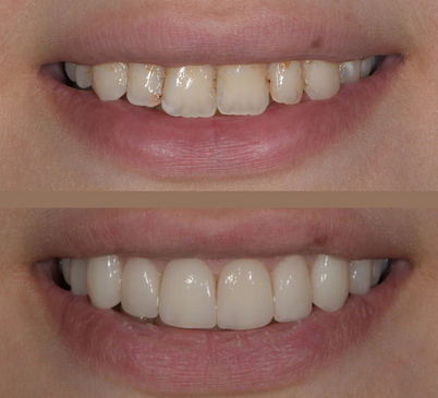 Slider image (3) UltimaDent